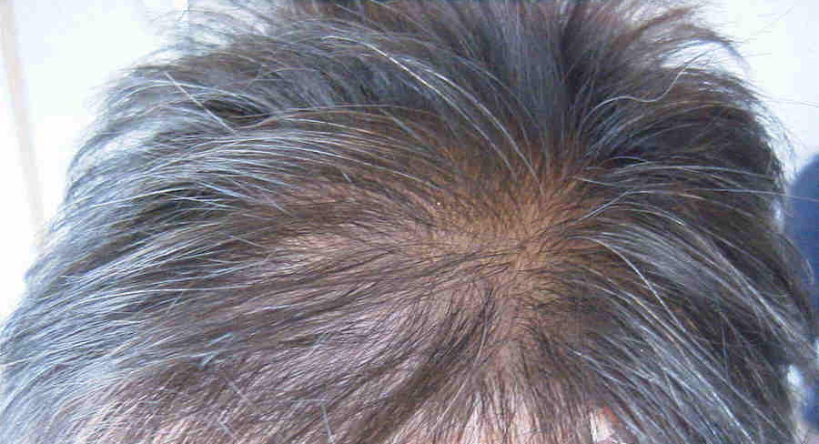 Thinning Hair in Women - Hairology.co.uk - 'The Root to Healthier Hair'.